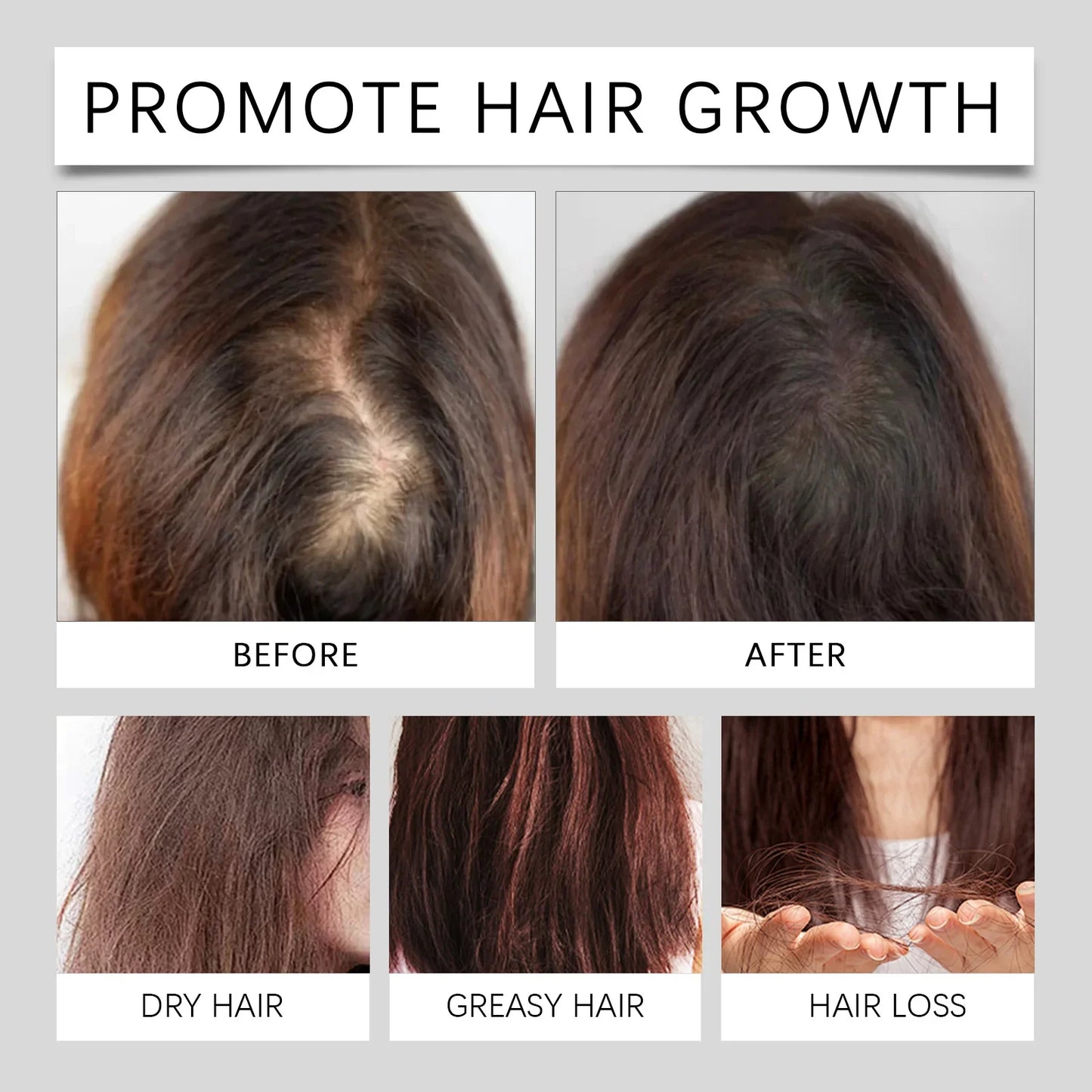 Natural Hair Growth Oil for Men and Women 60ml-1