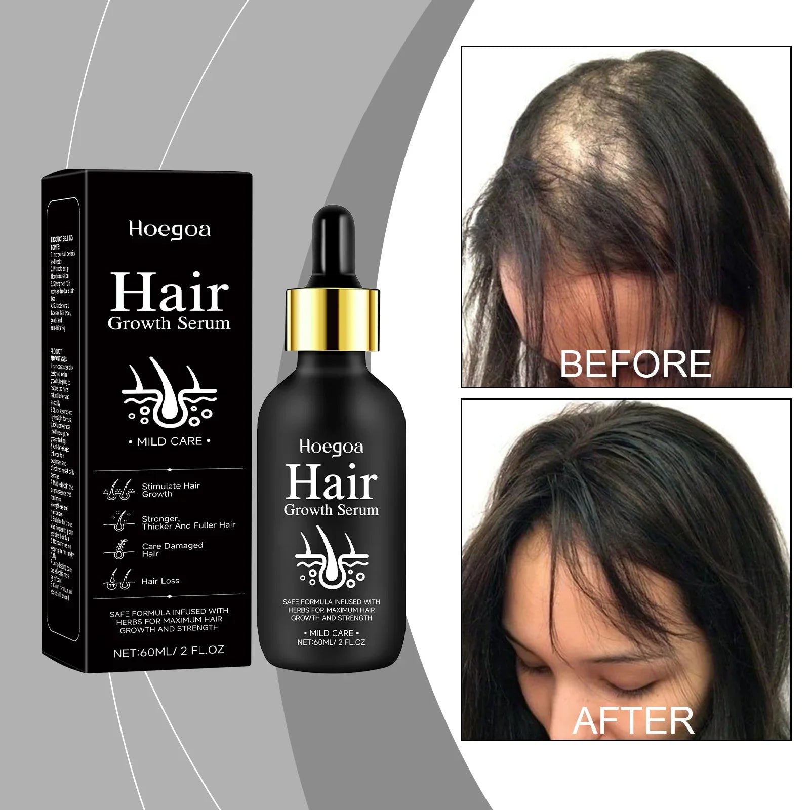 Natural Hair Growth Oil for Men and Women 60ml-0