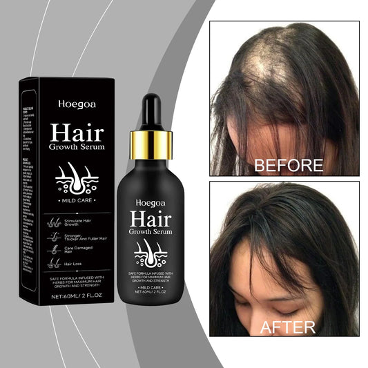 Natural Hair Growth Oil for Men and Women 60ml-0